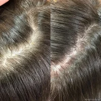студия восстановления и выпрямления волос vibeplex изображение 4